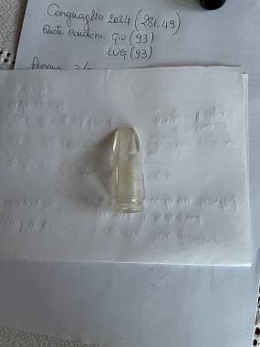 Becco in resina trasparente soprano