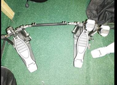 Doppio pedale batteria Xdrum